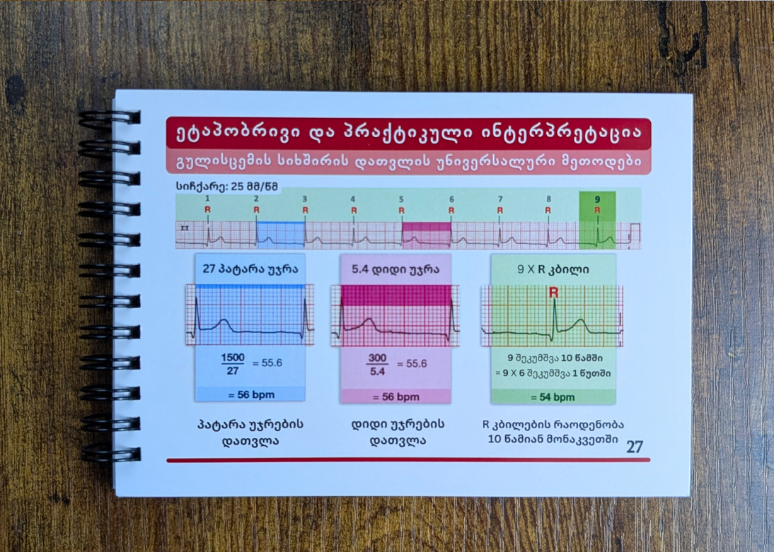 ეკგ გზამკვლევი